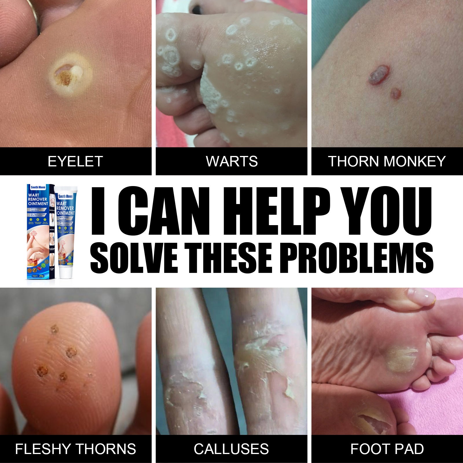 Hand Foot Face Underarm Wart Removing Cream