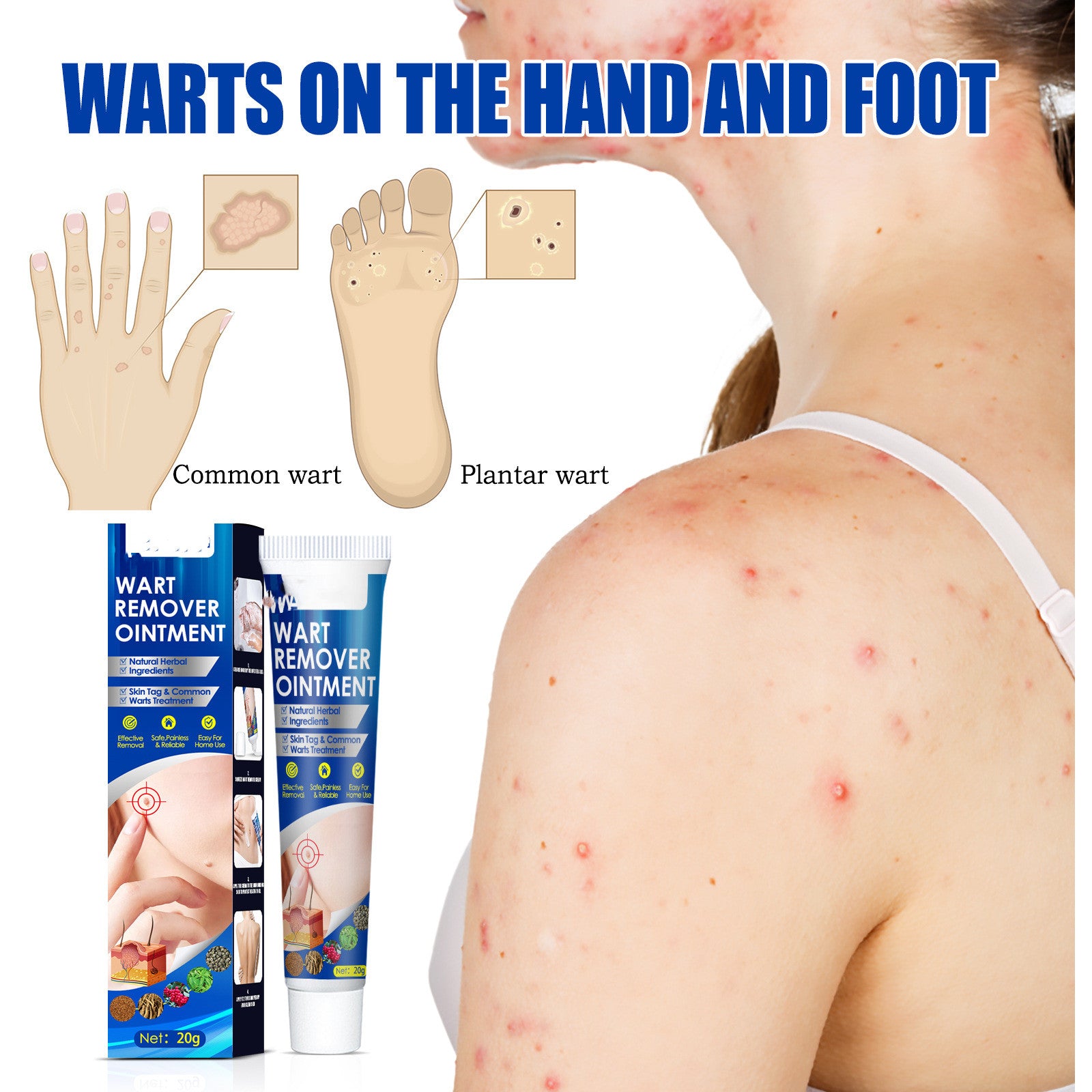 Hand Foot Face Underarm Wart Removing Cream